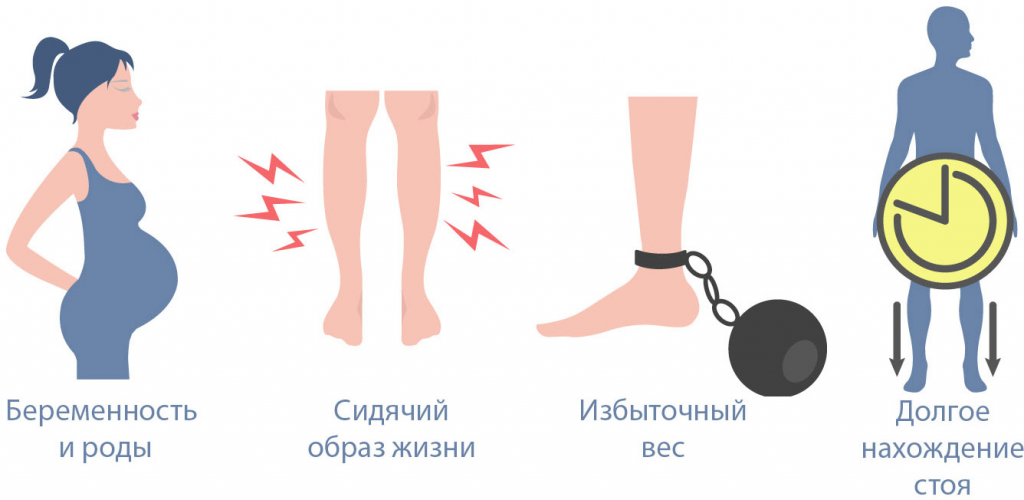Причины ретикулярного варикоза