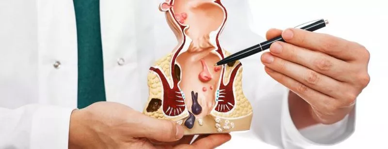 Обследование у проктолога без страха и боли: разбираем аноскопию и ректороманоскопию