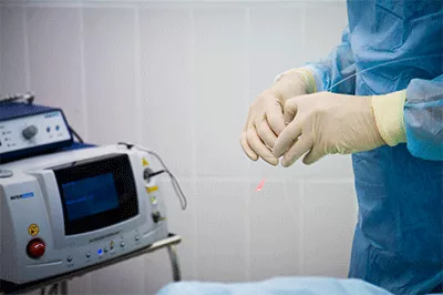 Лечение варикоза лазером